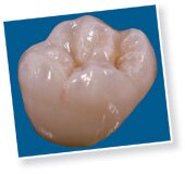 Prettau Vollzirkonkrone